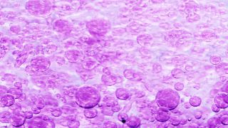 Link to Video | liquid, background, drop, vaccination, shuffling, purple, water, multicolored, violet blue, mixing, poison, violet, derivative work, lava lamp, oil, Brause