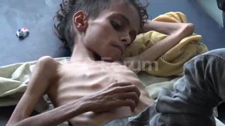 Link to Video | March 19, Agence France-Presse